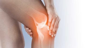 Migliori ortopedici ginocchio